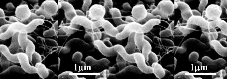 Campylo bacter fertőzések